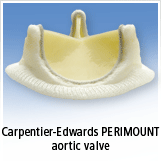 PERIMOUNT Bovine Heart Valve Replacement