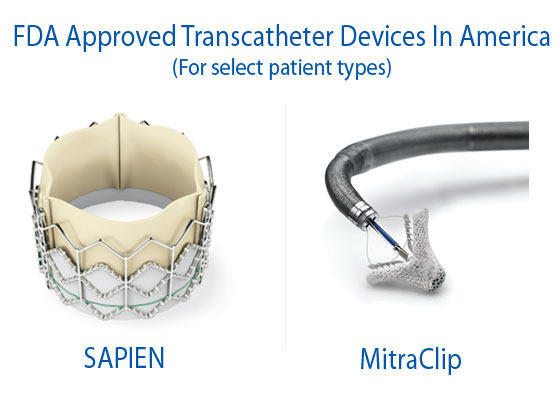 FDA Approved Transcatheter Valve Devices