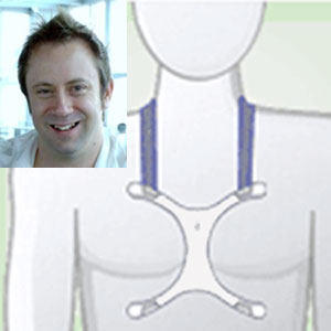 Incision Shield Story