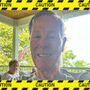 John Warns About Tissue Valve Complications