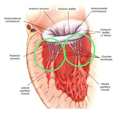 Mitral Valve Chordae