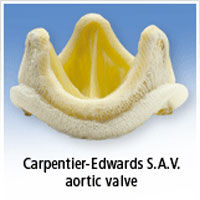 Aortic Pig Valve Replacement
