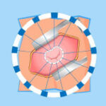 Risk for Heart Valve Surgery