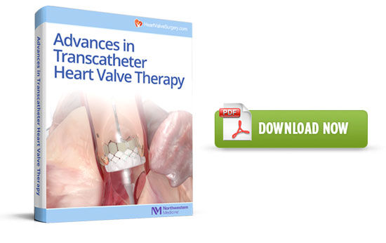 Transcatheter Heart Valve eBook
