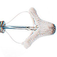 Clinical Trial Update: TRILUMINATE Launches to Rescue â€œForgottenâ€ Tricuspid Valve