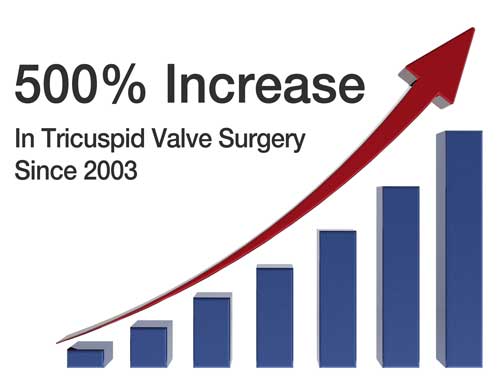 Tricuspid Valve Surgery Increase During Past 10 Years