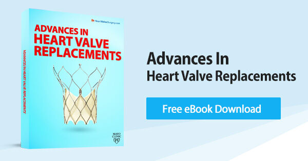 Advances in Heart Valve Replacements eBook Download