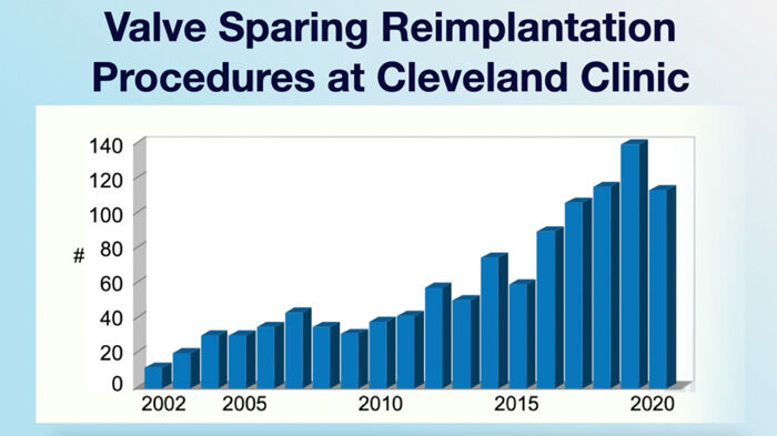 Valve-Sparing Aortic Root Replacement Volume at Cleveland Clinic