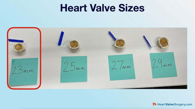Heart Valve Replacement Sizes
