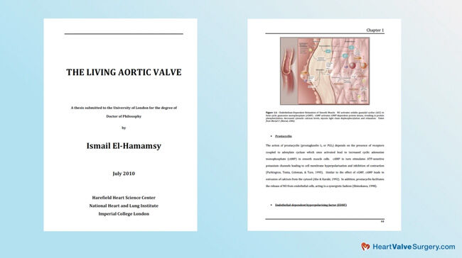Living Aortic Valve by Dr. Ismail El-Hamamsy