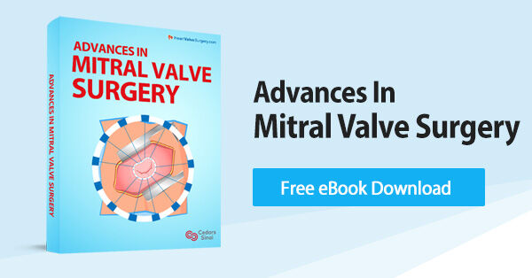 Advances in Mitral Valve Surgery eBook - Free Download