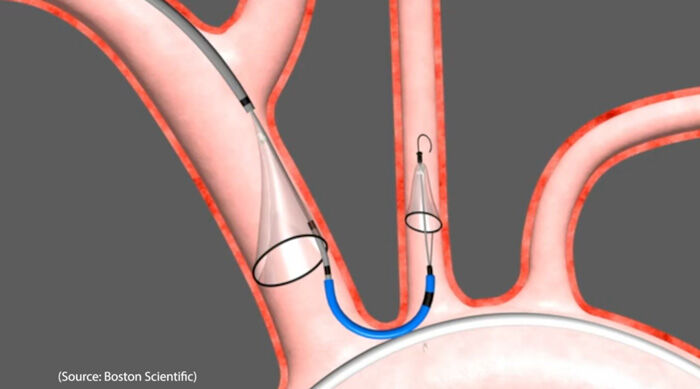 SENTINEL-Cerebral-Protection-System-TAVR