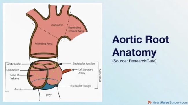 Aortic Root Anatomy Drawing