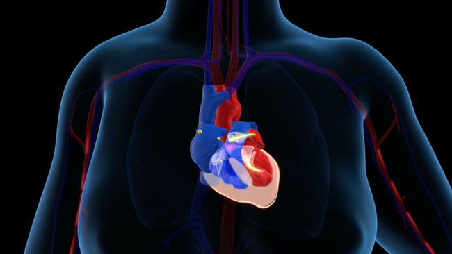 Atrial Fibrillation Electrical Heart Diagram