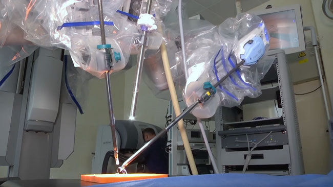 Da Vinci Robot for Mitral Valve Repair Surgery at Cleveland. Clinic