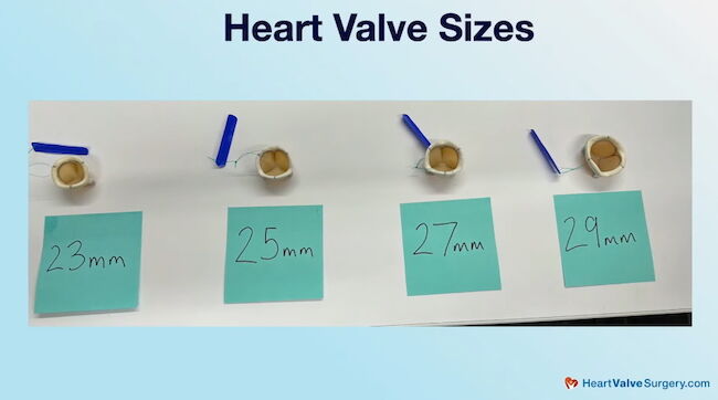 Heart Valve Sizes