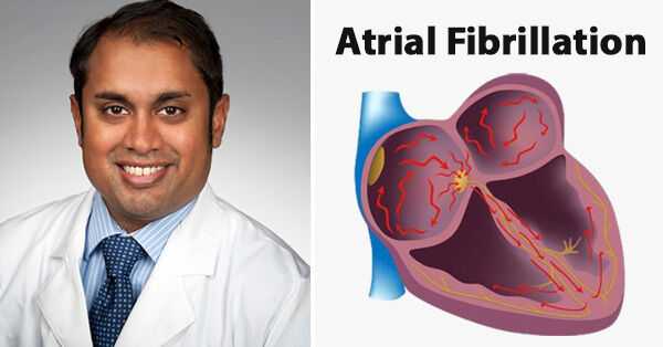 Dr. Hemal Gada - Q&A About Afib