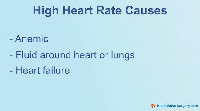 Causes of High Heart Rates after Heart Surgery