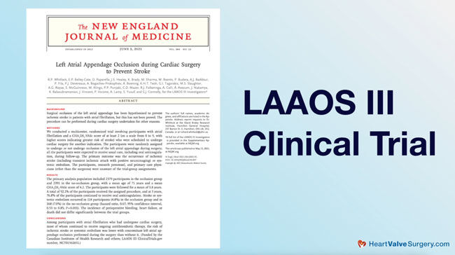 LAAOS-Clinical-Trial-Atrial-Fibrillation