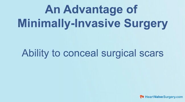 Advantage of Minimally Invasive Heart Valve Surgery