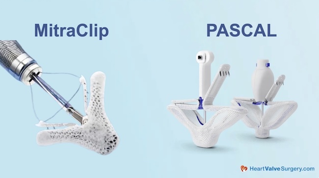 Mitral Repair Devices