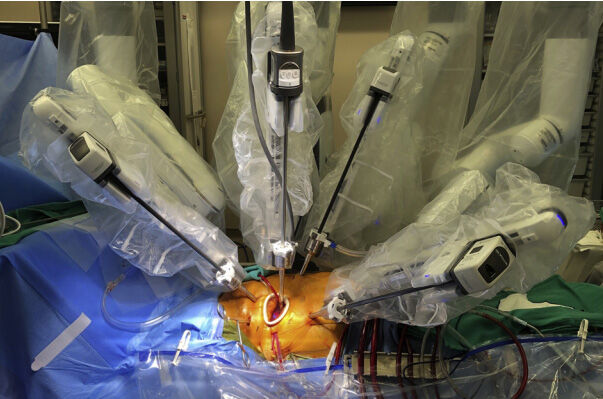 Robotic Aortic Valve Surgery Platform