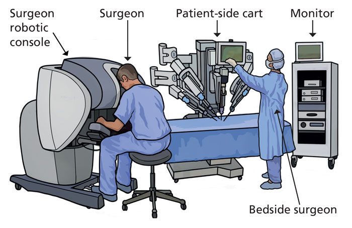 Robotic Surgery Setup and Console