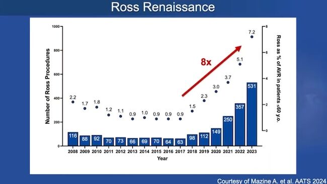 Ross Procedure Renaissance Statistics