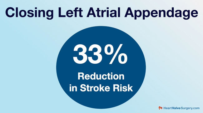 Stroke Risk Reduction for Left Atrial Appendage Closure