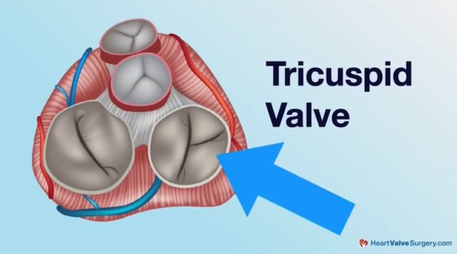 Tricuspid Valve Drawing