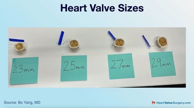 Heart Valve Replacement Sizes