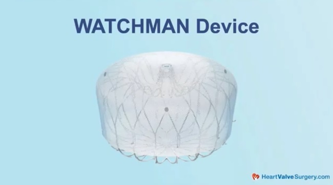 WATCHMAN Device