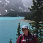 Janice West, heart valve patient