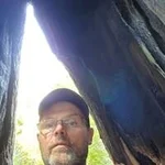 Tom Everson, heart valve patient