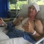 Michael Fisher, heart valve patient