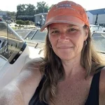 Kimberley Anchell, heart valve patient