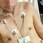 Garrett Payment, heart valve patient