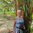 corinne Slade - Heart Valve Patient