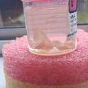 Karla Wratt - Heart Valve Patient