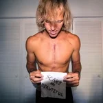 Derek Owens, heart valve patient