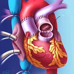 Paul Taylor, heart valve patient