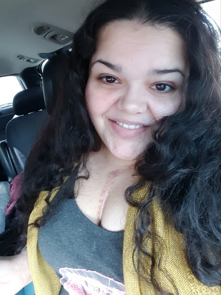 6 weeks post op after my first cardiac rehab session!
