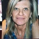 Nancy James, heart valve patient