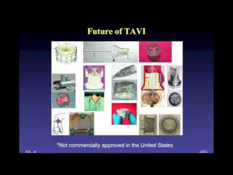 Special Patient Webinar: Advances In Aortic Valve Surgery Including TAVR