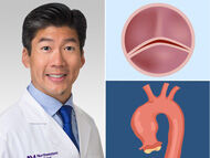 Surgeon Q&A: Bicuspid Aortic Valves, Connective Tissue Disorders & Aneurysms
