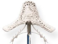 Technology Update: Transcatheter Mitral Valve Therapy with Dr. Steven Bolling