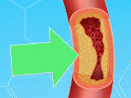 Top 9 Facts: Coronary Artery Disease & Heart Valve Surgery