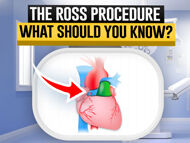 The Ross Procedure: What Should Patients Know?