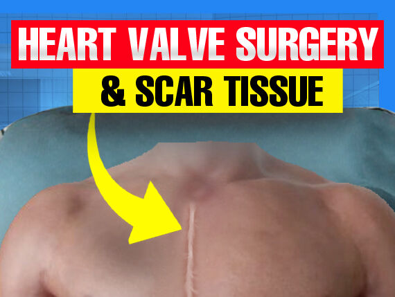 Surgeon Q&A: Scar Tissue and Minimally Invasive Heart Valve Reoperations