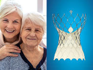 Recovery Insights: Is It Safe To Be Home Alone After TAVR?